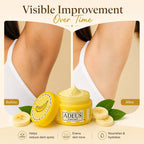 Dark Spot Correcting Cream for Underarms, Bikini Line & Body Areas
